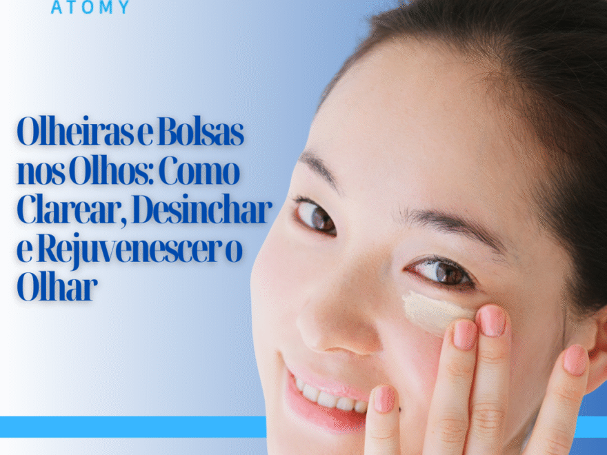 Olheiras e Bolsas nos Olhos