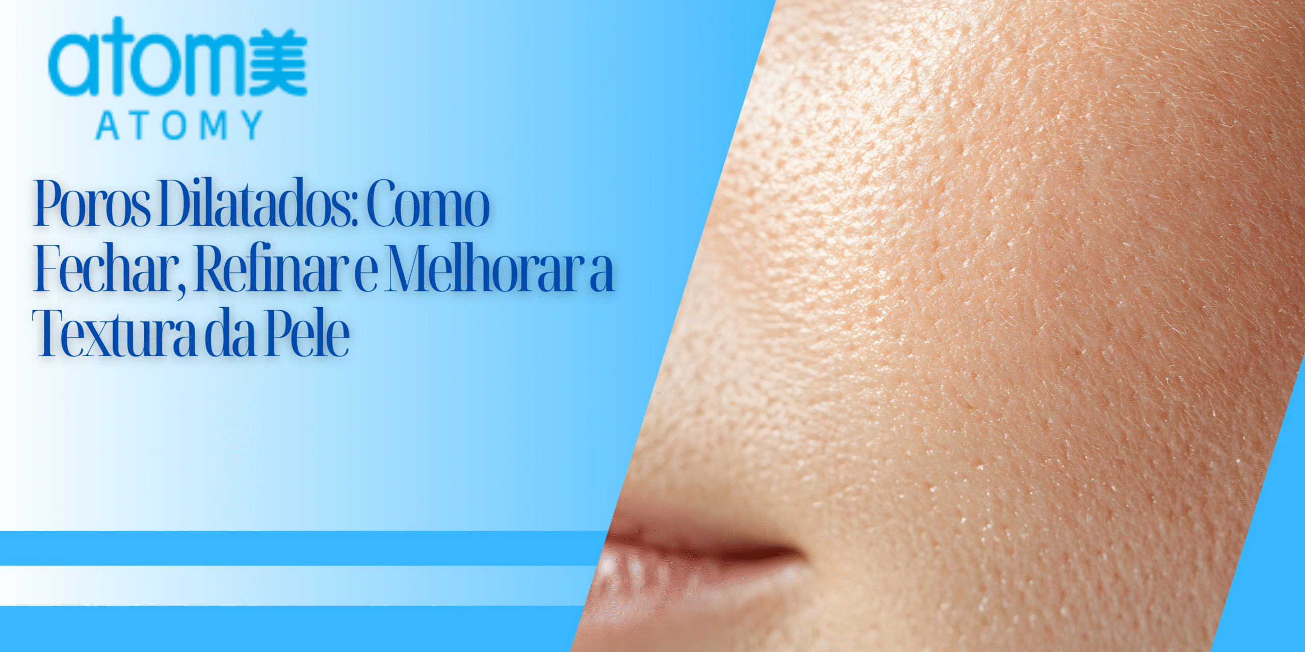 Poros Dilatados: Como Fechar, Refinar e Melhorar a Textura da Pele
